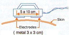 Figure 1 - In this portable assembly, the electrodes consist on metal plates.
