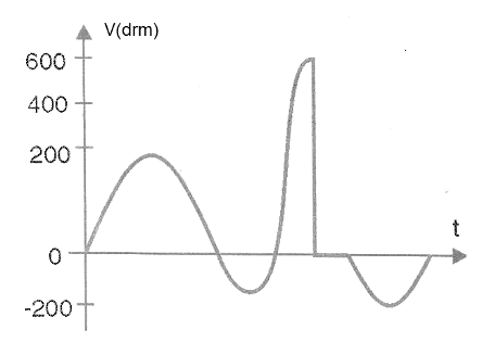 Figure 7 - Overcoming Vdrm
