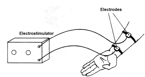 Figure 7 - An electrostimulator
