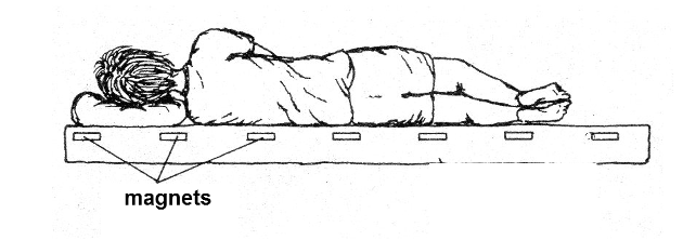 Figure 1 - An application of magnet therapy
