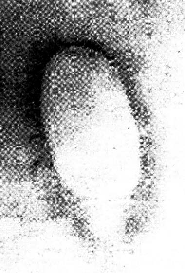 Figure 7 - Aura image of the authors fingertip on a piece of fax paper, scanned for placement in this book. 
