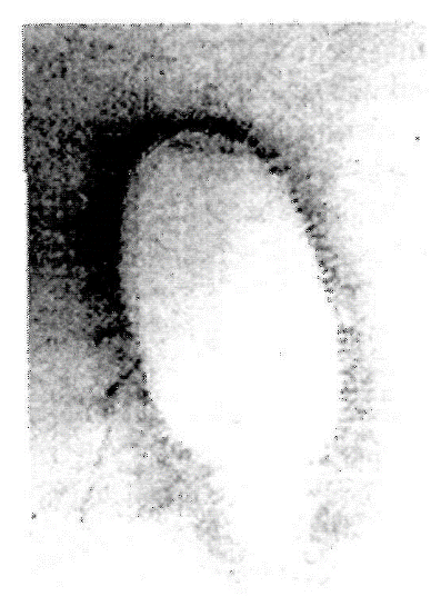 Figure 7 - Aura image of the author's fingertip on a piece of fax paper, scanned for placement in this book. The Kirlian machine used to make this image was the one de-scribed in Project. 
